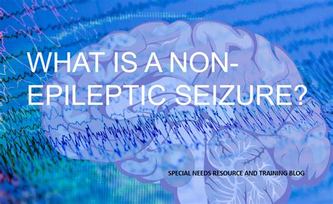 What Is A Non Epileptic Seizure Seizures Non Epileptic Seizures