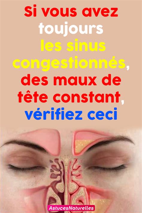 Le mal de tête fait partie intégrante de notre vie. Si vous avez toujours les sinus congestionnés, des maux de ...