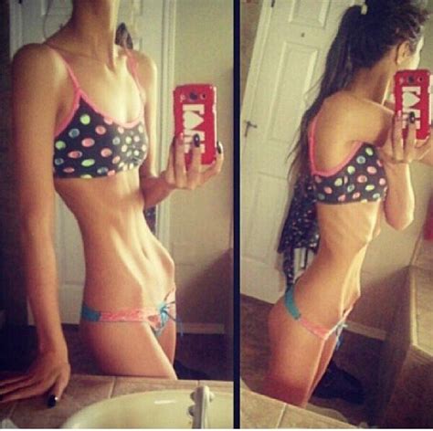 Anorexic Skinny Teen Telegraph