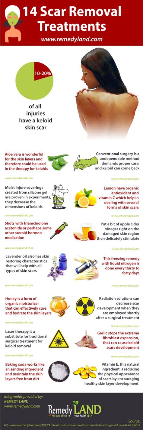 14 Keloid Skin Scar Removal Treatments Or How To Get Rid Of A Keloids
