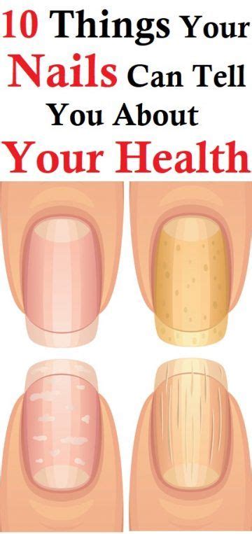 Things Your Nails Can Tell You About Your Health Health Nail Health