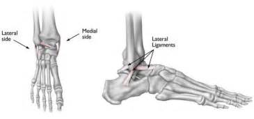 Sprained Ankle Orthoinfo Aaos