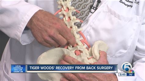 Tiger Woods Recovery From Back Surgery Youtube