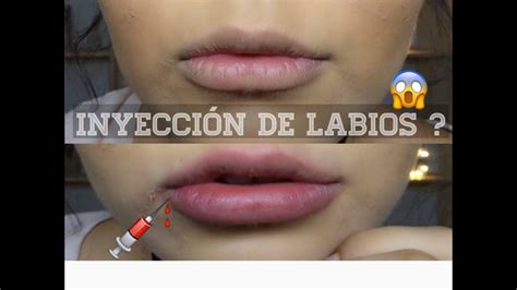 Inyecci N De Labios Hazlo T Misma Youtube