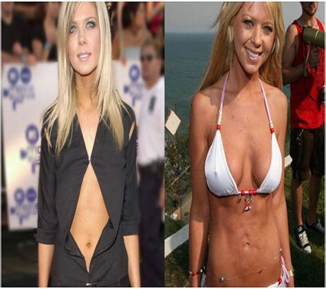 Tara Reid Before And After Celebrity Plastic Surgery Plastic Surgery Gone Wrong Bad