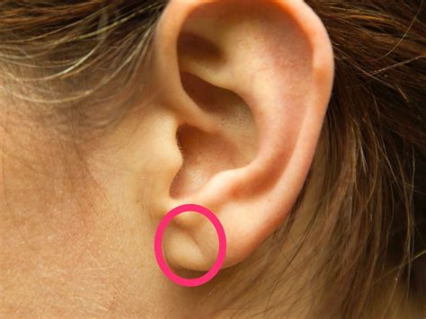 An Earlobe Crease May Predict Heart Disease For People Under 40 — Here