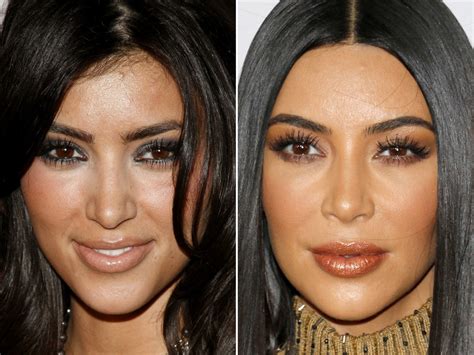 Kim Kardashian Before And After The Skincare Edit