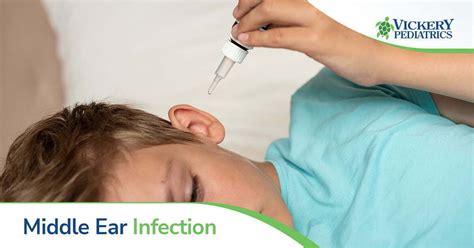 Causes And Treatment For A Childs Middle Ear Infection Vickery
