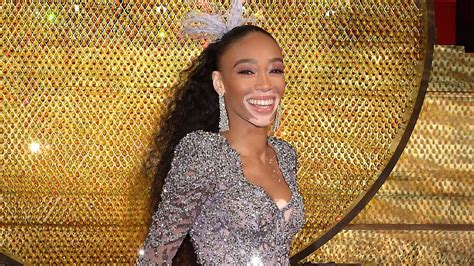 Winnie Harlow Makes History As Sports Illustrateds First Swimsuit