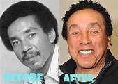 Smokey Robinson Plastic Surgery Before and After Pictures - Lovely ...