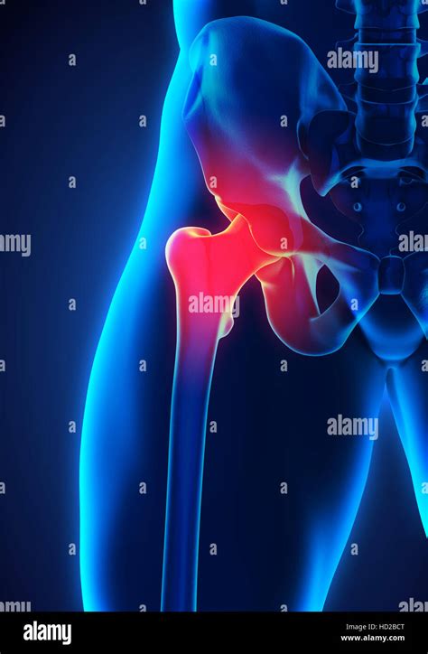 Painful Hip Joint Stock Photo Alamy