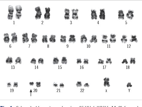 Figure 1 From Additional Genomic Aberrations Identified By Single