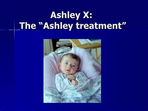 Ashley X The “ashley Treatment”