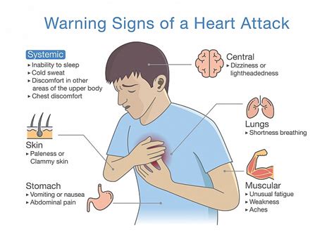 Coronary Heart Disease And Angina Symptoms Pelajaran