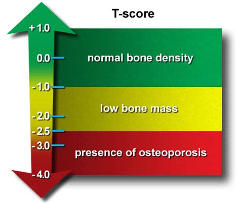National center for health statistics. Cost of Bone Mineral Density (BMD) Test | Singapore Sports ...
