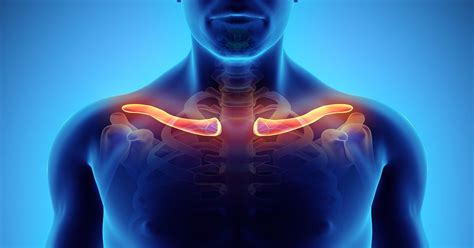 Clavicle Fractures Types And Symptoms