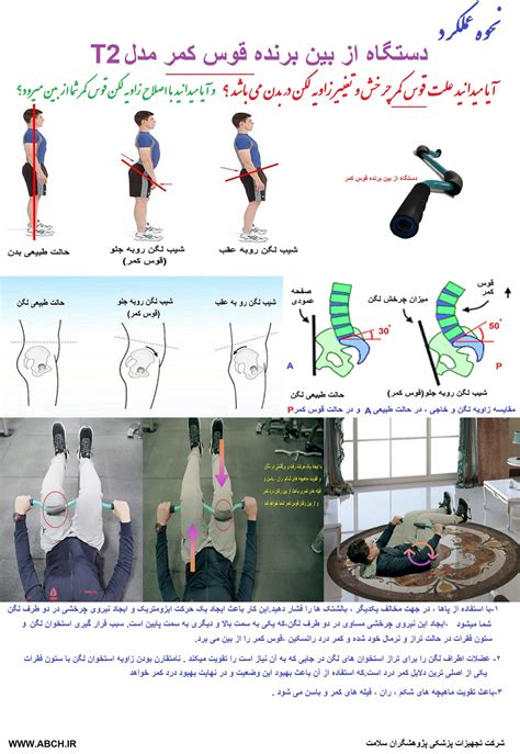 دستگاه قوس کمر t2 دستگاه برطرف کننده قوس کمر اودسا