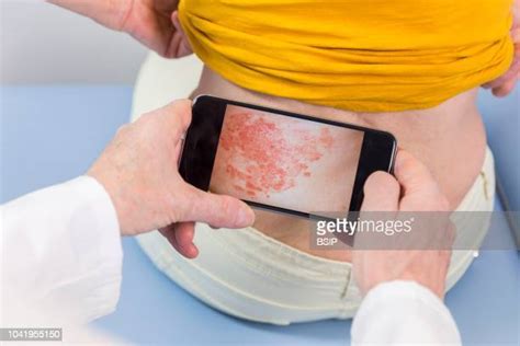 Psoriasis Patient Doctor Photos And Premium High Res Pictures Getty