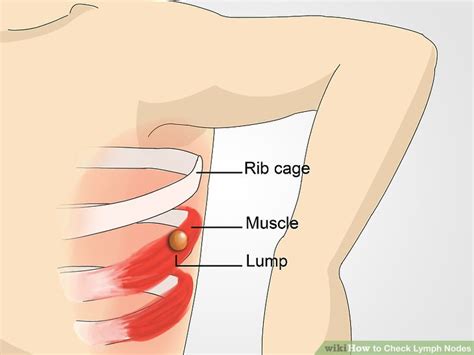 A variety of conditions can cause the appearance of an uneven rib cage. How to Check Lymph Nodes: 12 Steps (with Pictures) - wikiHow