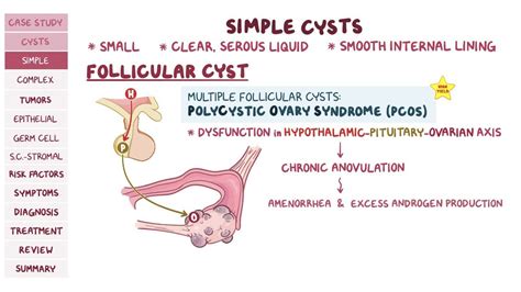 Ovarian Cysts And Tumors Pathology Review Video Osmosis