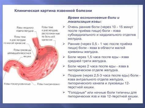 Диета язва двенадцатиперстной Язва Луковицы Двенадцатиперстной Кишки Диета — Похудение Диета Язва Луковицы Двенадцатиперстной Кишки Диета — Похудение Диета Диета язва двенадцатиперстной