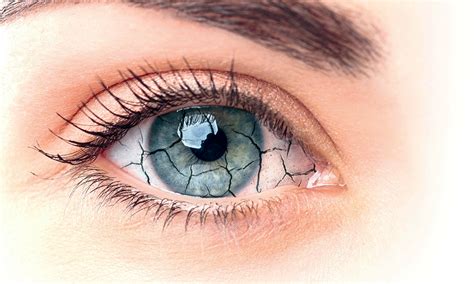 Mese Della Prevenzione E Cura DellOcchio Secco EYE DOCTOR