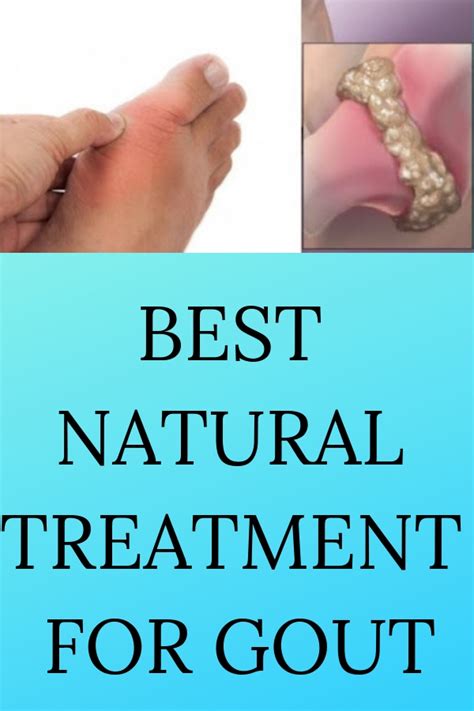 Best Natural Treatment For Gout