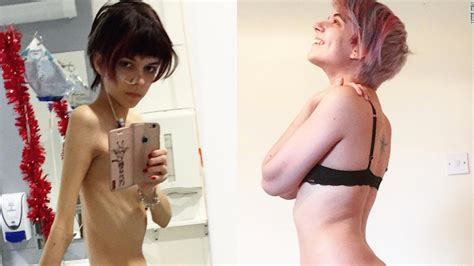 Sexy Anorexic Girls Telegraph