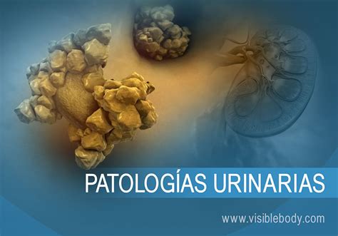 Patologias Do Sistema Urinário
