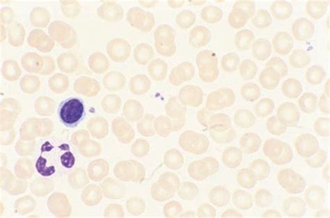 Image Peripheral Blood Smear Normal Msd Manual Professional Edition