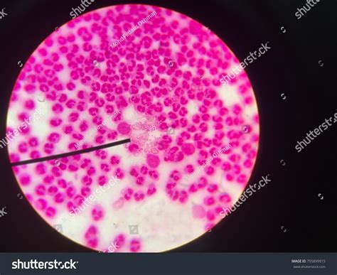 Gram Negative Diplococci Intracellular Extracellular Resemble ภาพสต็อก