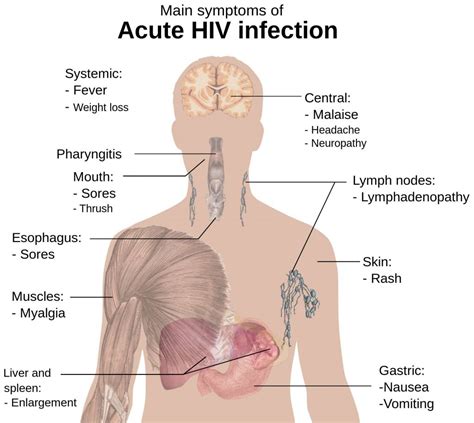 Hiv Signs And Symptoms Mens Sexual Health Clinic