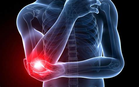 Understanding Elbow Pain Causes Symptoms And Treatment Options