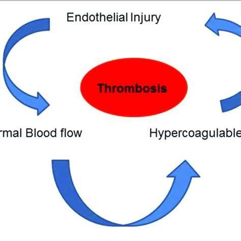 Virchows Triad Comprising Of Blood Flow Vascular Endothelial Injury