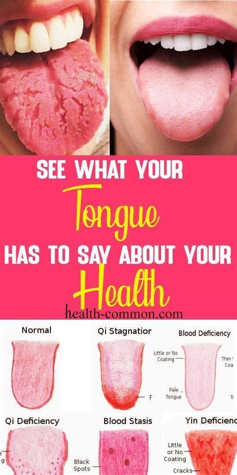 Tips For Nail And Tongue Health Health Care In 2021 Tongue Health