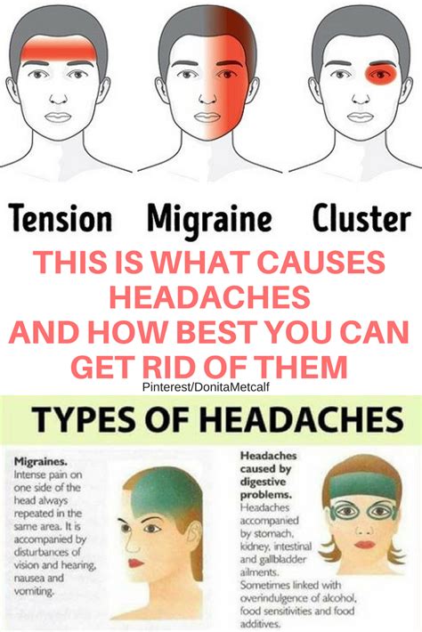 What Is A Migraine Headache Caused By Karin Good Bruidstaart