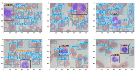 Cells Yolo V Object Detection Dataset And Pre Trained Model By Cell My Xxx Hot Girl