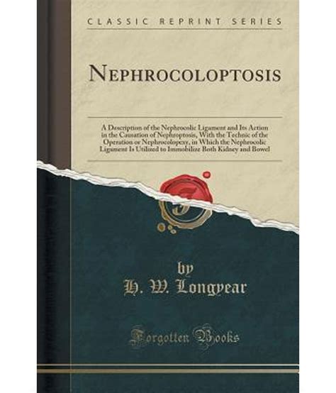 Nephrocoloptosis A Description Of The Nephrocolic Ligament And Its