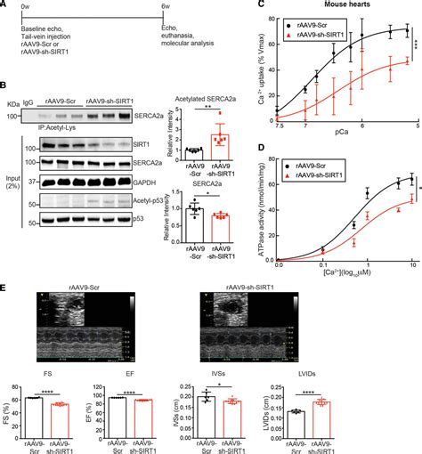 Role Of Sirt1 In Modulating Acetylation Of The Sarco Endoplasmic