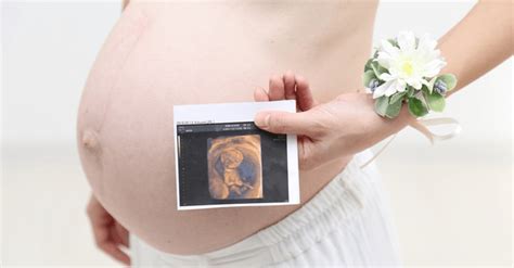妊娠36週目（36w1d～4d）のエコー写真とエピソード｜妊娠10ヶ月｜cozre[コズレ]子育てマガジン