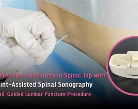 Increased Precision And Safety In Spinal Tap With Pass An Ultrasound