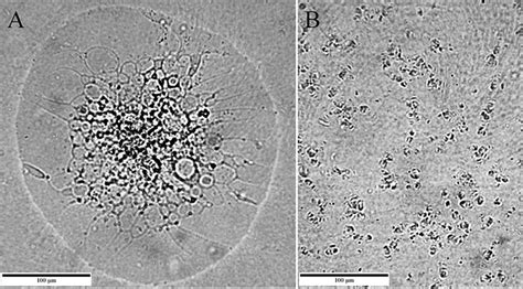 Microcolonies A Novel Morphological Form Of Pathogenic Mycoplasma Spp