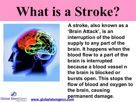 What Is Stroke Risk Factors Causes Types And Diagnosis Of Stroke