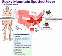 Image - Rocky Mountain Spotted Fever, RMSF - RoshReview.com