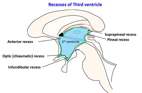 Third Ventricle Location Boundaries Recesses And Choroid Plexus
