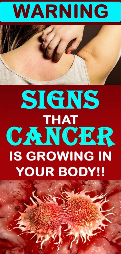 16 Early Warning Signs Of Cancer In Your Body Should Not Ignore Healthy Lifestyle