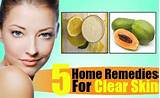 Home Remedies Clear Skin Images