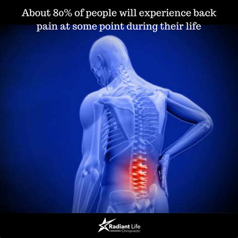 Low Back Pain Dont Accept Being Another Statistic Radiant Life