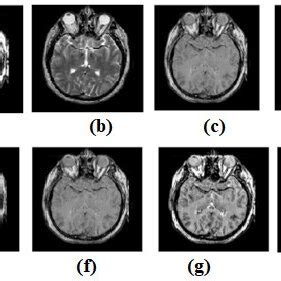 Multi Modality Medical Image Fusion Results A Source Image CT B