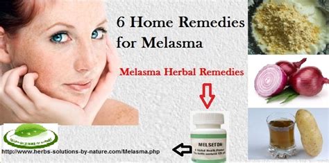 6 Home Remedies For Melasma Herbs Solutions By Nature